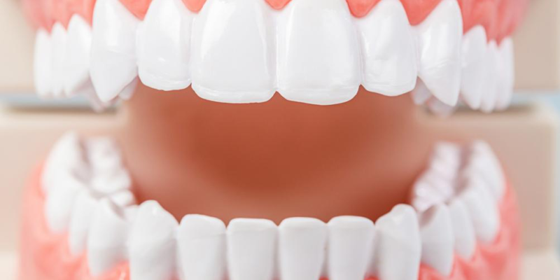 Everything You Need To Know About Periodontitis