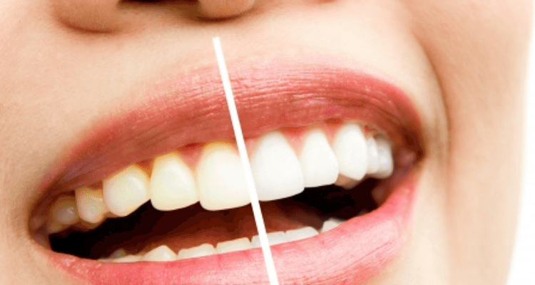 3 Common Dental Problems And How To Avoid Them