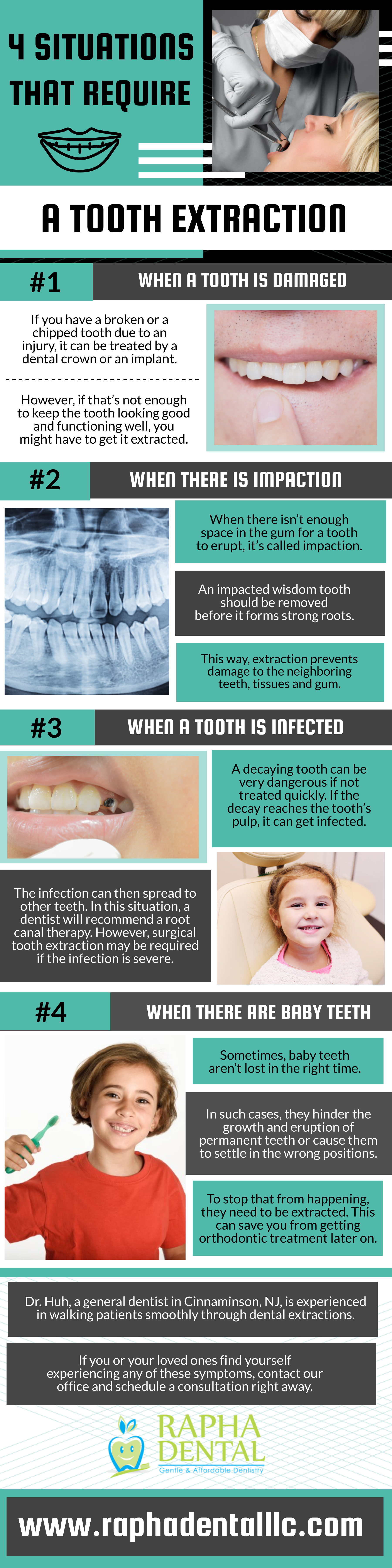 4 Situations that require a Tooth Extraction