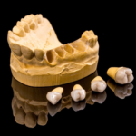 Dental Implant Surgery: Things to Avoid Immediately After Treatment