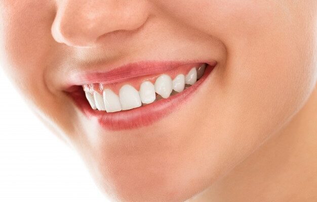 A woman with healthy gums and white teeth smiling