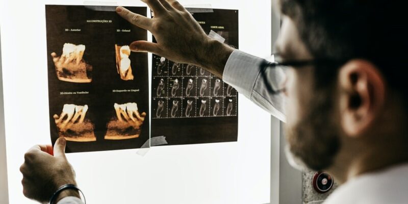 A dentist reading a dental X-ray