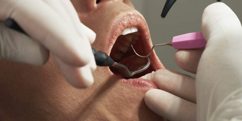 Dentist performing root canal surgery