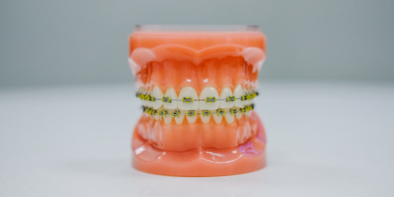 An anatomical model of the teeth and gums