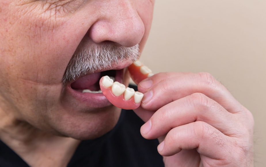 An old man wearing a partial denture
