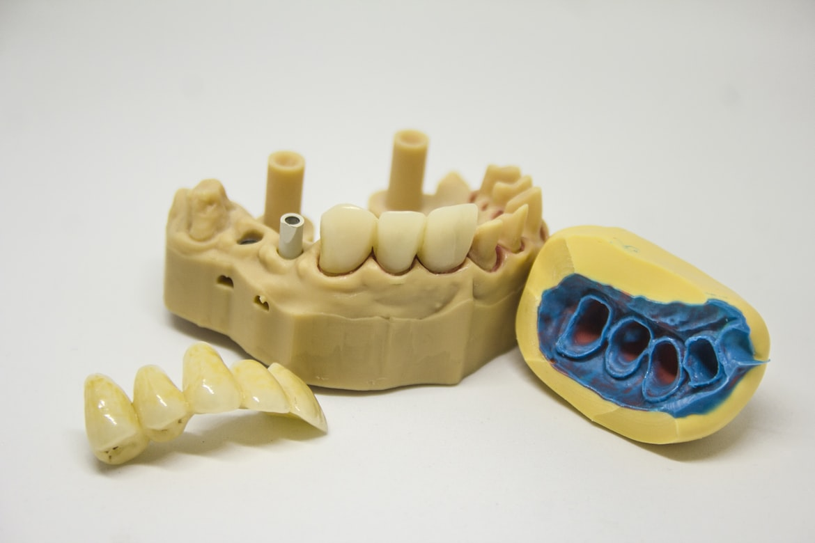 Lab-prepared dental crowns